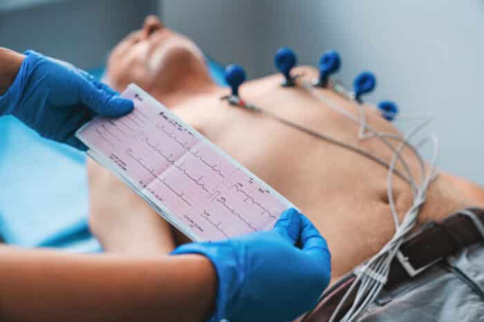 Technician holding ECG Test