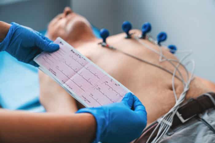 Electrocardiogram AKA ECG