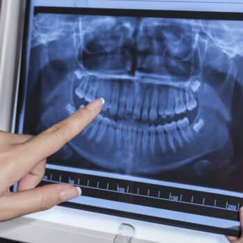 dental x-rays.